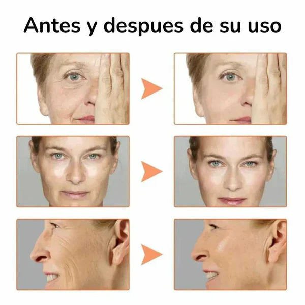 Nuevo serum anti-edad:  Recupera tu juventud en 2 semanas (OFERTA 2X1)